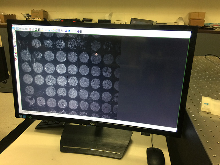 Computer images of lung cancer cells